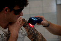 20230907-cold laser arm tattoo-DSC_4984