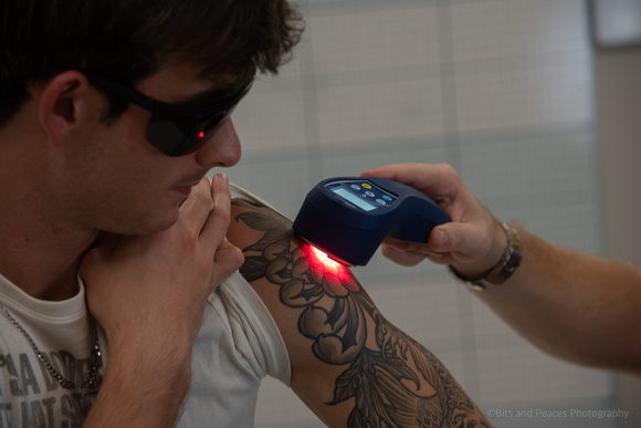 20230907-cold laser arm tattoo-DSC_4984