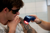 20230907-cold laser arm tattoo-DSC_4983