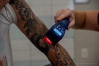 20230907-cold laser arm tattoo-DSC_4987