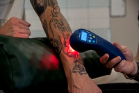20230907-cold laser arm tattoo-DSC_4996