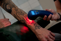 20230907-cold laser arm tattoo-DSC_4999